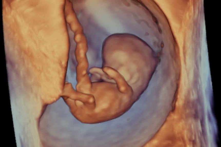 Ultraschallbild eines Embryos in 3D